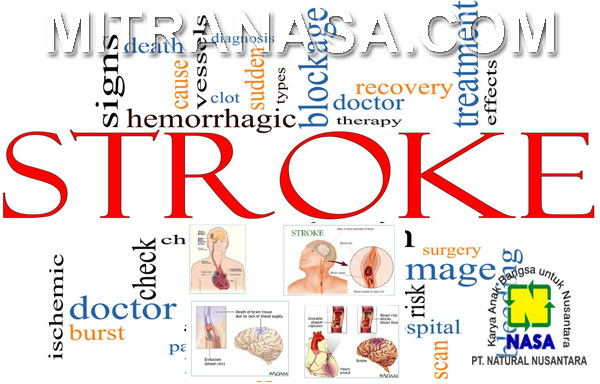 Produk Nasa Untuk Mengatasi Penyakit Stroke